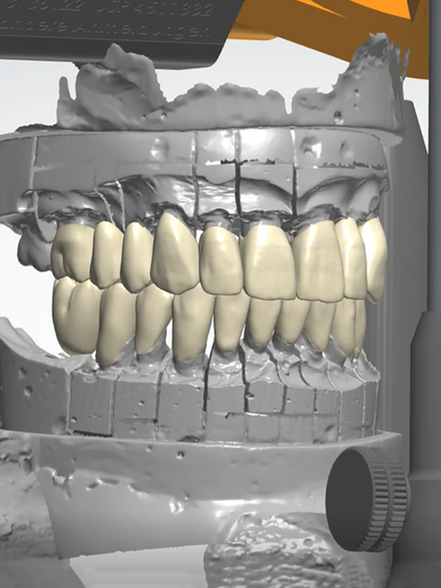 Rehabilitación Oral Clínica Vallegrande