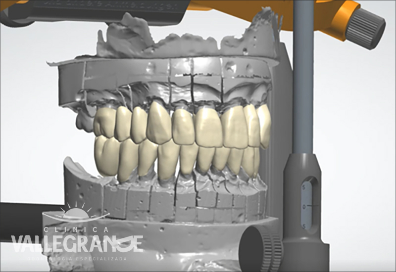 Rehabilitacion Oral Clínica Vallegrande